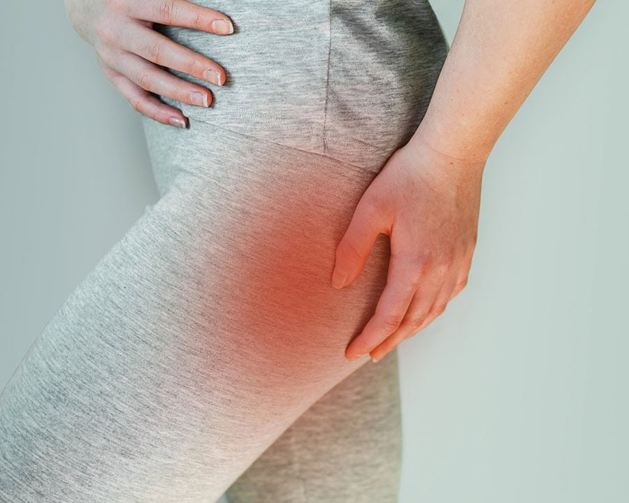 A woman suffers from piriformis syndrome, pain in buttocks muscle