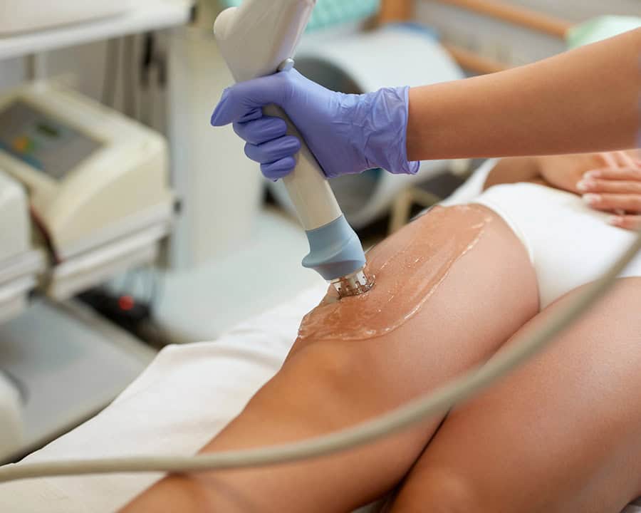 Woman receiving shockwave treatment on the thigh in physiotherapy clinic